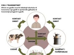 Turbekulozi, si kalon nga kafsha te njeriu dhe si të mbrohemi