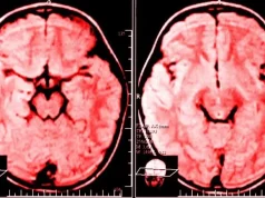 Shkenca shpjegon se çfarë i ndodh trurit të dikujt që ankohet çdo ditë. Ankesat na ndryshojnë mënyrën e të menduarit dhe na bëjnë njerëz negativë. Por ka një zgjidhje…