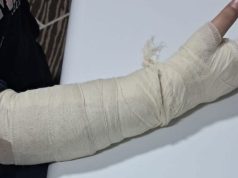 Skandal në Shkup: Mësuesja e bën për spital 10-vjeçaren nga Çairi