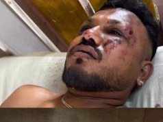 Dy të mbijetuar nga rrëzimi i avionit të Air India. Pasagjeri i ulur në sediljen 11A rrëfen tmerrin: “Isha mes kufomave”