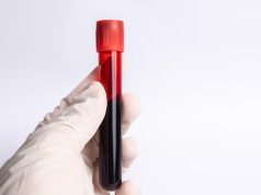 Shkencëtarët francezë zbulojnë një grup të ri gjaku, “Gwada negativ”