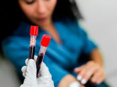 Rezultate shpresëdhënëse nga testi i gjakut për 50 lloje kanceri