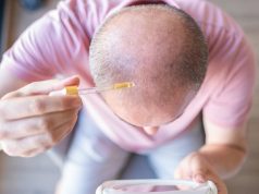 Serumi eksperimental që rikthen flokët për 20 ditë