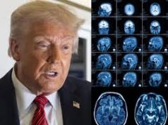 Trump mburret me shëndetin e tij pas rezonancës magnetike: “Mjeku më tha se ishin rezultatet më të mira që ka parë ndonjëherë”
