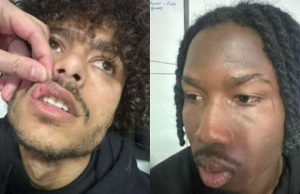 Iliria-Skënderbeu, policia: Konflikti në dhomat e zhveshjes, një futbollist i plagosur! Nis procedimi për tre të tjerë