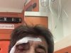 Goditet me grusht gazetari Ilir Demaliaj, autori në kërkim. Ngjarja në Tiranë, policia identifikon autorin e dyshuar dhe sekuestron automjetin e përdorur