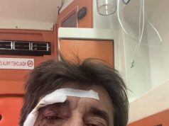 Goditet me grusht gazetari Ilir Demaliaj, autori në kërkim. Ngjarja në Tiranë, policia identifikon autorin e dyshuar dhe sekuestron automjetin e përdorur