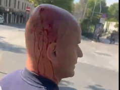Ministria e Shëndetësisë: 17 të lënduar nga protesta po marrin trajtim, jashtë rrezikut