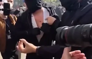 Plumba gome ndaj protestuesve në Tiranë, PD kërkon dorëheqjen e Ramës! Këlliçi: Mbi 10 të rinj të plagosur